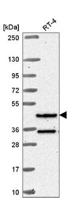 Western Blot: RFX8 Antibody [NBP2-58601] - Analysis in human cell line RT-4.