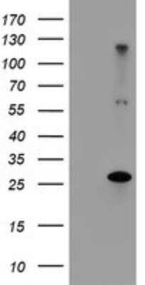Western Blot: RFXANK Antibody (OTI3B4) - Azide and BSA Free [NBP2-73868] - Analysis of HEK293T cells were transfected with the pCMV6-ENTRY control (Left lane) or pCMV6-ENTRY RFXANK .