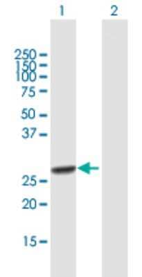Western Blot: RFXANK Antibody [H00008625-B01P] - Analysis of RFXANK expression in transfected 293T cell line by RFXANK polyclonal antibody.  Lane 1: RFXANK transfected lysate(26.07 KDa). Lane 2: Non-transfected lysate.
