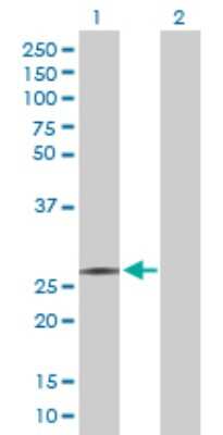 Western Blot: RFXANK Antibody [H00008625-D01P] - Analysis of RFXANK expression in transfected 293T cell line by RFXANK polyclonal antibody.Lane 1: RFXANK transfected lysate(25.60 KDa).Lane 2: Non-transfected lysate.