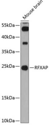 Western Blot: RFXAP Antibody [NBP2-93758] - Analysis of extracts of mouse brain, using RFXAP at 1:3000 dilution.Secondary antibody: HRP Goat Anti-Rabbit IgG (H+L) at 1:10000 dilution.Lysates/proteins: 25ug per lane.Blocking buffer: 3% nonfat dry milk in TBST.Detection: ECL Basic Kit .Exposure time: