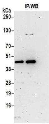 Immunoprecipitation: RG9MTD1 Antibody [NBP2-32078] - Samples:  Whole cell lysate (0.5 or 1.0 mg per IP reaction; 20% of IP loaded) prepared using NETN buffer from HeLa cells. Antibodies:  Affinity purified rabbit anti-RG9MTD1 antibody NBP2-32078 used for IP at 6 ug per reaction.  RG9MTD1 was also immunoprecipitated by rabbit anti-RG9MTD1 antibody BL15333.  For blotting immunoprecipitated RG9MTD1, NBP2-32078 was used at 1 ug/ml.  Detection:  Chemiluminescence with an exposure time of 3 minutes.