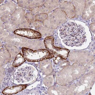 Immunohistochemistry-Paraffin: RG9MTD2 Antibody [NBP2-13226] - Staining of human kidney shows strong cytoplasmic and membranous positivity in cells in tubules.