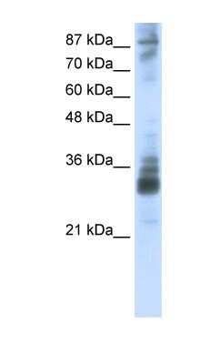 Western Blot: RG9MTD2 Antibody [NBP1-80478] - HepG2 cell lysate, concentration 2.5 ug/ml.