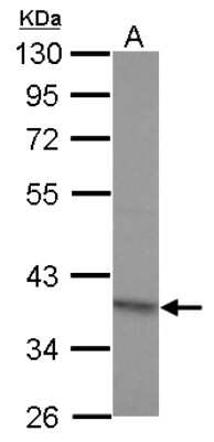 Western Blot RG9MTD2 Antibody - BSA Free