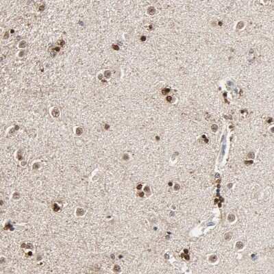 Immunohistochemistry-Paraffin: RGAG4 Antibody [NBP1-93561] - Staining of human lateral ventricle shows strong nuclear positivity in glial cells.