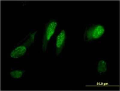 Immunocytochemistry/Immunofluorescence: RGC32 Antibody (3B9) [H00028984-M01] - Analysis of monoclonal antibody to C13orf15 on HeLa cell . Antibody concentration 10 ug/ml.