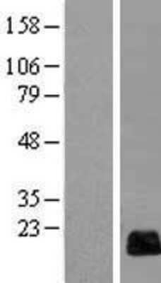 Western Blot: RGC32 Overexpression Lysate (Adult Normal) [NBL1-08157] Left-Empty vector transfected control cell lysate (HEK293 cell lysate); Right -Over-expression Lysate for RGC32.