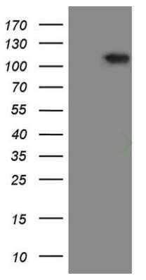 Western Blot: RGL2 Antibody (OTI10F2) - Azide and BSA Free [NBP2-73875] - HEK293T cells were transfected with the pCMV6-ENTRY control (Left lane) or pCMV6-ENTRY RGL2 (Right lane) cDNA for 48 hrs and lysed. Equivalent amounts of cell lysates (5 ug per lane) were separated by SDS-PAGE and immunoblotted with anti-RGL2.