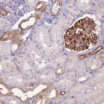 Immunohistochemistry-Paraffin: RGL3 Antibody [NBP1-92326] - Staining of human kidney shows strong positivity in cells in glomeruli and moderate staining in cells in tubules.