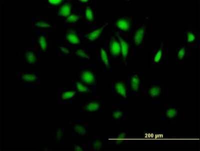 Immunocytochemistry/Immunofluorescence: RGL4 Antibody [H00266747-B01P] - Analysis of purified antibody to Rgr on HeLa cell. (antibody concentration 10 ug/ml)