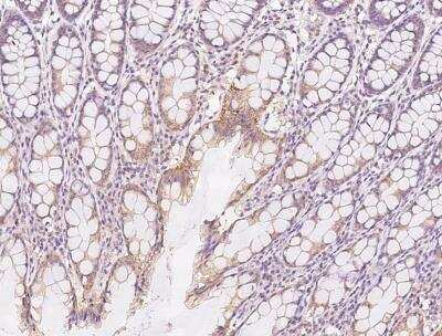 Immunohistochemistry-Paraffin: RGL4 Antibody [NBP3-05804] - Staining of human RGL4 in human rectum with rabbit polyclonal antibody at 1:100 dilution.