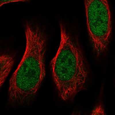 Immunocytochemistry/Immunofluorescence: RGM-A Antibody [NBP2-58165] - Staining of human cell line U-2 OS shows localization to nucleoplasm & nuclear bodies.