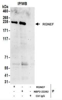 Immunoprecipitation: RGNEF Antibody [NBP2-22282] - Whole cell lysate (1 mg for IP; 20% of IP loaded) from HeLa cells.  Antibodies: Affinity purified rabbit anti-RGNEF antibody NBP2-22282 used for IP at 6 ug/mg lysate.  RGNEF was also immunoprecipitated by rabbit anti-RGNEF antibody.  For blotting immunoprecipitated RGNEF, NBP2-22282 was used at 1 ug/ml.  Detection: Chemiluminescence with an exposure time of 3 minutes.