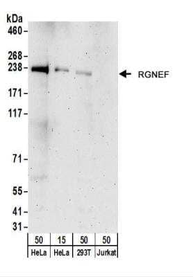 Western Blot: RGNEF Antibody [NBP2-22282] - Whole cell lysate from HeLa (15 and 50 ug), 293T (50 ug),  and Jurkat (50 ug) cells.  NBP2-22282 used for WB at 0.4 ug/ml.  Detection: Chemiluminescence with an exposure time of 3 minutes.