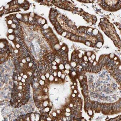 Immunohistochemistry-Paraffin RGP1 Antibody - BSA Free