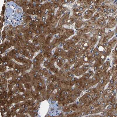 Immunohistochemistry-Paraffin: RGP1 Antibody [NBP1-89622] - Staining of human liver shows strong cytoplasmic positivity in hepatocytes.