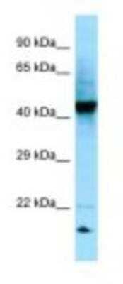 Western Blot: RGP1 Antibody [NBP1-98602] - 721_B Cell Lysate 1.0ug/ml, Gel Concentration: 12%