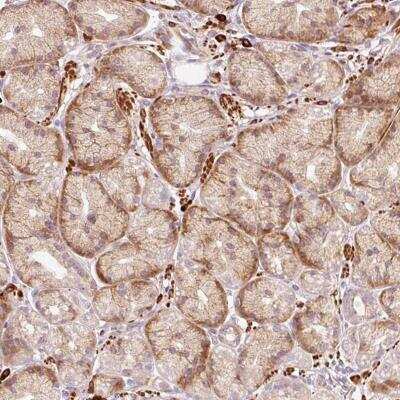 Immunohistochemistry-Paraffin: RGPD1 Antibody [NBP2-46789] - Analysis of human stomach, lower shows moderate cytoplasmic positivity in glandular cells.