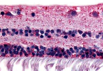 Immunohistochemistry-Paraffin: RGR Antibody [NBP3-06674] - RGR Antibody IHC of human retina. Immunohistochemistry of formalin-fixed, paraffin-embedded tissue after heat-induced antigen retrieval.