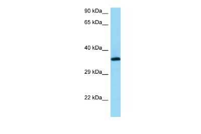 Western Blot: RGR Antibody [NBP2-84244] - WB Suggested Anti-RGR Antibody. Titration: 1.0 ug/ml. Positive Control: PANC1 Whole CellRGR is supported by BioGPS gene expression data to be expressed in PANC1