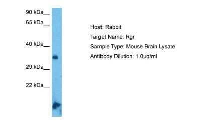 Western Blot: RGR Antibody [NBP2-84245] - Host: Rabbit. Target Name: RGR. Sample Tissue: Mouse Brain lysates. Antibody Dilution: 1ug/ml