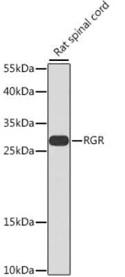 Western Blot: RGR Antibody [NBP2-93641] - Analysis of extracts of rat spinal cord, using RGR at 1:1000 dilution.Secondary antibody: HRP Goat Anti-Rabbit IgG (H+L) at 1:10000 dilution.Lysates/proteins: 25ug per lane.Blocking buffer: 3% nonfat dry milk in TBST.Detection: ECL Basic Kit .Exposure time: 90s.