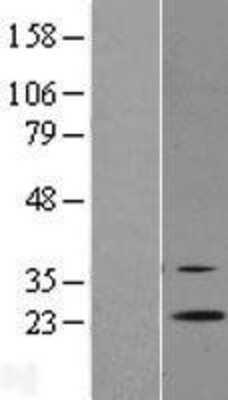 Western Blot: RGR Overexpression Lysate (Adult Normal) [NBL1-15318] Left-Empty vector transfected control cell lysate (HEK293 cell lysate); Right -Over-expression Lysate for RGR.