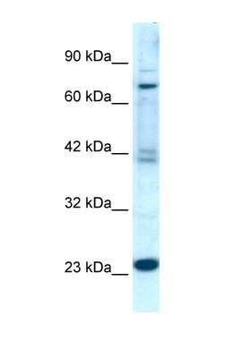 Western Blot: RGS10 Antibody [NBP1-55396] - Bone marrow derived monocytes, Antibody Titration: 0.2-1 ug/ml