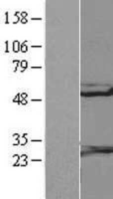 Western Blot RGS10 Overexpression Lysate