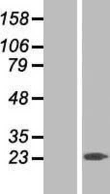 Western Blot RGS10 Overexpression Lysate