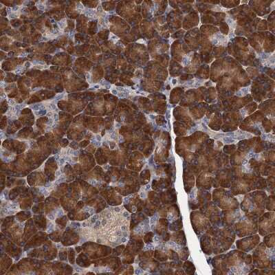 Immunohistochemistry: RGS11 Antibody [NBP2-48745] - Staining of human pancreas shows strong cytoplasmic positivity in exocrine glandular cells.