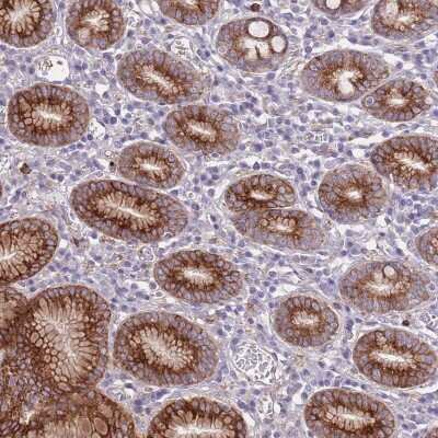 Immunohistochemistry: RGS11 Antibody [NBP2-48781] - Staining of human stomach, lower shows strong cytoplasmic and membranous positivity in glandular cells.