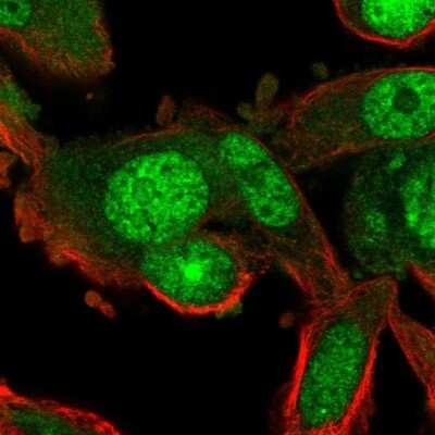 Immunocytochemistry/Immunofluorescence: RGS12 Antibody [NBP2-56165] - Staining of human cell line PC-3 shows localization to nucleus, nucleoli & cytosol.