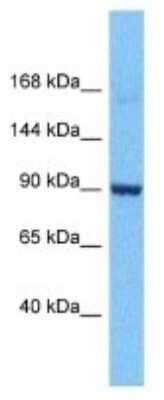 Western Blot: RGS12 Antibody [NBP3-09983] - Western blot analysis of RGS12 in Human Hela Whole Cell. Antibody dilution at 1.0ug/ml