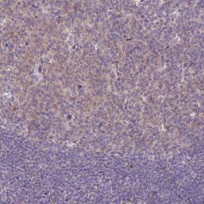 Immunohistochemistry-Paraffin: RGS13 Antibody [NBP1-92328] - Staining of human tonsil shows moderate cytoplasmic positivity in germinal center cells.