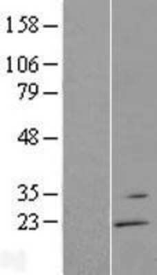 Western Blot: RGS13 Overexpression Lysate (Adult Normal) [NBP2-08057] Left-Empty vector transfected control cell lysate (HEK293 cell lysate); Right -Over-expression Lysate for RGS13.