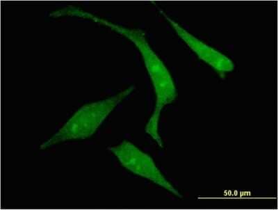 Immunocytochemistry/Immunofluorescence: RGS14 Antibody (2F8) [H00010636-M03] - Analysis of monoclonal antibody to RGS14 on HeLa cell. Antibody concentration 10 ug/ml