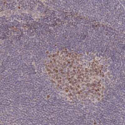 <b>Orthogonal Strategies Validation. </b>Immunohistochemistry-Paraffin: RGS14 Antibody [NBP2-13227] - Staining of human lymph node shows moderate nuclear and cytoplasmic positivity in germinal center cells.