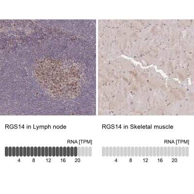 Immunohistochemistry-Paraffin: RGS14 Antibody [NBP2-13227] - Staining in human lymph node and skeletal muscle tissues using anti-RGS14 antibody. Corresponding RGS14 RNA-seq data are presented for the same tissues.