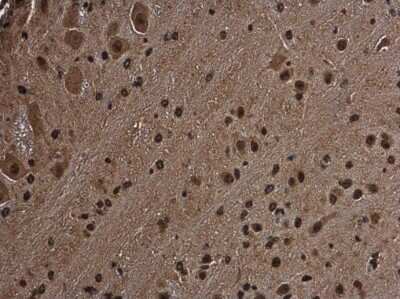 Immunohistochemistry-Paraffin: RGS14 Antibody [NBP3-12912] - RGS14 antibody detects RGS14 protein at cytoplasm and nucleus in mouse brain by immunohistochemical analysis. Sample: Paraffin-embedded mouse brain. RGS14 antibody (NBP3-12912) diluted at 1:500. Antigen Retrieval: Citrate buffer, pH 6.0, 15 min