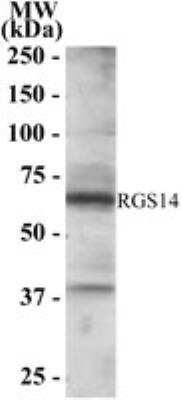 Western Blot: RGS14 Antibody [NB100-1431] - NB100-1431 staining of Jurkat lysate (RIPA buffer, 35 ug total protein per lane). Primary antibody (0.5 ug/ml) incubated for 1 hour. Detected by western blot using chemiluminescence.