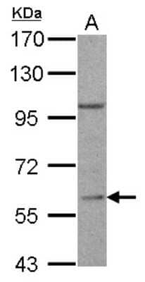 Western Blot: RGS14 Antibody [NBP1-31174] - 30 ug Jurkat whole lysate/extract, 7.5% SDS-PAGE gel, dilution 1:500.