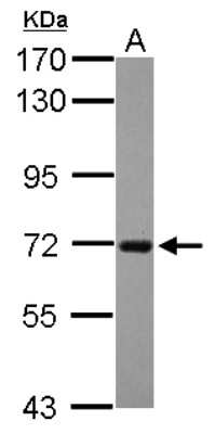 Western Blot: RGS14 Antibody [NBP2-20147] - Sample (30 ug of whole cell lysate) A: Raji 7. 5% SDS PAGE gel, diluted at 1:1000.