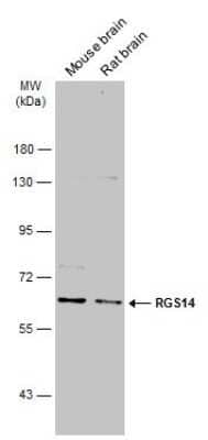 Western Blot: RGS14 Antibody [NBP3-12912] - Various tissue extracts (50 ug) were separated by 7.5% SDS-PAGE, and the membrane was blotted with RGS14 antibody (NBP3-12912) diluted at 1:1000. The HRP-conjugated anti-rabbit IgG antibody (NBP2-19301) was used to detect the primary antibody.