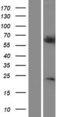 Western Blot: RGS14 Overexpression Lysate (Adult Normal) [NBP2-07614] Left-Empty vector transfected control cell lysate (HEK293 cell lysate); Right -Over-expression Lysate for RGS14.