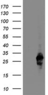 Western Blot: RGS16 Antibody (OTI2C9) - Azide and BSA Free [NBP2-73884] - Analysis of HEK293T cells were transfected with the pCMV6-ENTRY control (Left lane) or pCMV6-ENTRY RGS16.