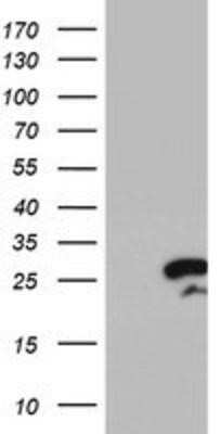 Western Blot: RGS16 Antibody (OTI4E5) - Azide and BSA Free [NBP2-73881] - HEK293T cells were transfected with the pCMV6-ENTRY control (Left lane) or pCMV6-ENTRY RGS16 (Right lane) cDNA for 48 hrs and lysed. Equivalent amounts of cell lysates (5 ug per lane) were separated by SDS-PAGE and immunoblotted with anti-RGS16.