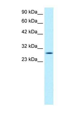 Western Blot: RGS16 Antibody [NBP1-55382] - Jurkat cell lysate, concentration 1.0ug/ml.