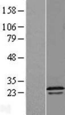 Western Blot: RGS16 Overexpression Lysate (Adult Normal) [NBL1-15322] Left-Empty vector transfected control cell lysate (HEK293 cell lysate); Right -Over-expression Lysate for RGS16.